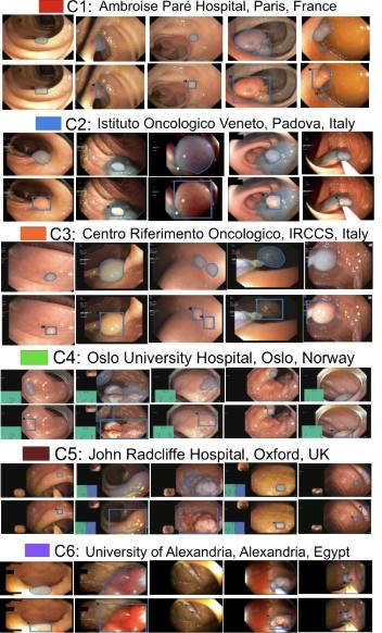 Key figure: PolypGen samples from six centres across France, Italy, Norway, the UK and Egypt, with masks and boxes.